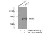 STXBP3 Antibody in Immunoprecipitation (IP)