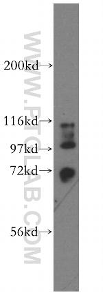 STXBP3 Antibody in Western Blot (WB)