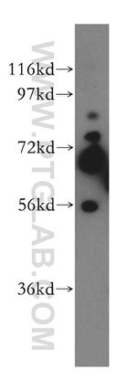 STXBP3 Antibody in Western Blot (WB)