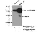 PCYT1B Antibody in Immunoprecipitation (IP)