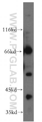 PCYT1B Antibody in Western Blot (WB)