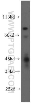 PCYT1B Antibody in Western Blot (WB)