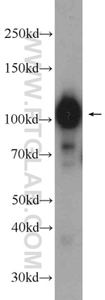 GPRIN1 Antibody in Western Blot (WB)