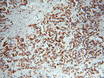 P-cadherin Antibody in Immunohistochemistry (Paraffin) (IHC (P))