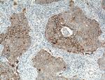 P-cadherin Antibody in Immunohistochemistry (Paraffin) (IHC (P))