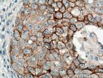 P-cadherin Antibody in Immunohistochemistry (Paraffin) (IHC (P))