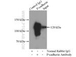 P-cadherin Antibody in Immunoprecipitation (IP)