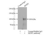 DZIP1 Antibody in Immunoprecipitation (IP)