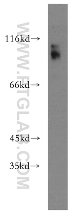 DZIP1 Antibody in Western Blot (WB)