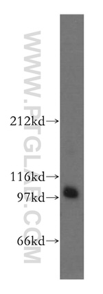 DZIP1 Antibody in Western Blot (WB)