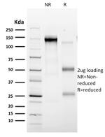 CD35/CR1 (Follicular Dendritic Cell Marker) Antibody in SDS-PAGE (SDS-PAGE)