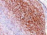 CD35/CR1 (Follicular Dendritic Cell Marker) Antibody in Immunohistochemistry (Paraffin) (IHC (P))