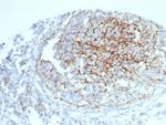 CD35/CR1 (Follicular Dendritic Cell Marker) Antibody in Immunohistochemistry (Paraffin) (IHC (P))