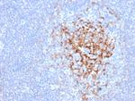 CD35/CR1 (Follicular Dendritic Cell Marker) Antibody in Immunohistochemistry (Paraffin) (IHC (P))