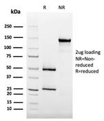 CD35/CR1 (Follicular Dendritic Cell Marker) Antibody in SDS-PAGE (SDS-PAGE)