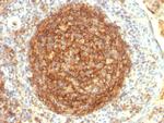 CD35/CR1 (Follicular Dendritic Cell Marker) Antibody in Immunohistochemistry (Paraffin) (IHC (P))