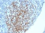 CD35/CR1 (Follicular Dendritic Cell Marker) Antibody in Immunohistochemistry (Paraffin) (IHC (P))