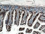 FABP6 Antibody in Immunohistochemistry (Paraffin) (IHC (P))