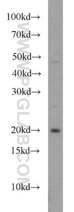 RAP2A Antibody in Western Blot (WB)