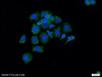 Radixin Antibody in Immunocytochemistry (ICC/IF)