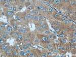 Radixin Antibody in Immunohistochemistry (Paraffin) (IHC (P))