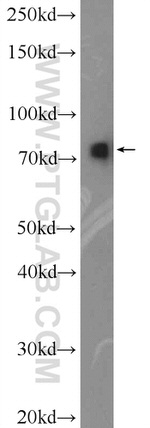 Radixin Antibody in Western Blot (WB)