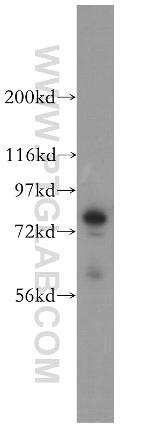 Radixin Antibody in Western Blot (WB)