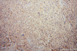 Spartin/SPG20 Antibody in Immunohistochemistry (Paraffin) (IHC (P))