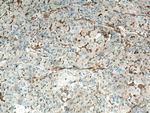 Spartin/SPG20 Antibody in Immunohistochemistry (Paraffin) (IHC (P))