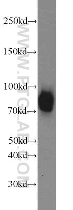 Spartin/SPG20 Antibody in Western Blot (WB)