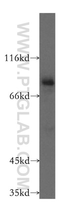 Spartin/SPG20 Antibody in Western Blot (WB)