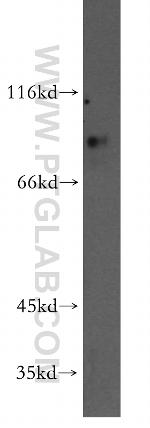 PRDM4 Antibody in Western Blot (WB)