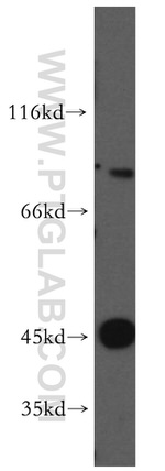 PRDM4 Antibody in Western Blot (WB)