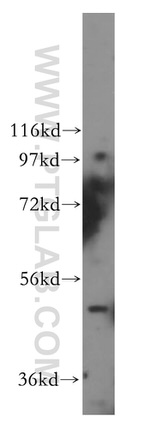 WBSCR16 Antibody in Western Blot (WB)