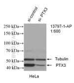 Pentraxin 3 Antibody in Western Blot (WB)