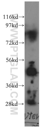 Pentraxin 3 Antibody in Western Blot (WB)