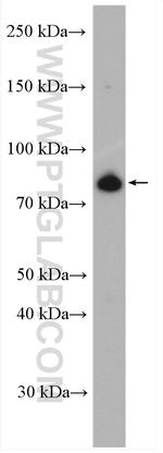 MFN1 Antibody in Western Blot (WB)