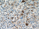 PAI-1 Antibody in Immunohistochemistry (Paraffin) (IHC (P))