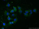 PAI-1 Antibody in Immunocytochemistry (ICC/IF)