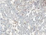 PAI-1 Antibody in Immunohistochemistry (Paraffin) (IHC (P))