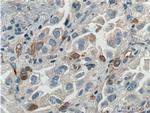 PAI-1 Antibody in Immunohistochemistry (Paraffin) (IHC (P))