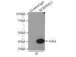 PAI-1 Antibody in Immunoprecipitation (IP)