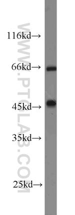 DARS2 Antibody in Western Blot (WB)