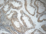 DARS2 Antibody in Immunohistochemistry (Paraffin) (IHC (P))