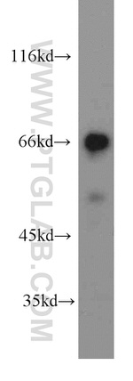 DARS2 Antibody in Western Blot (WB)