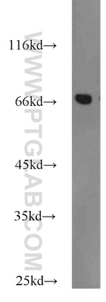 DARS2 Antibody in Western Blot (WB)