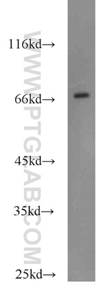 DARS2 Antibody in Western Blot (WB)