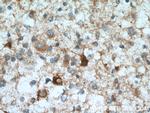 DYNC1I1 Antibody in Immunohistochemistry (Paraffin) (IHC (P))