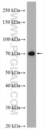 DYNC1I1 Antibody in Western Blot (WB)