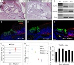 Connexin 26 Antibody in Immunohistochemistry (IHC)